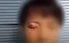 The injured face of the Korean man who was attacked by three Caucasians in Sydney last December [SCREEN CAPTURE]