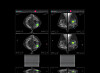 Lunit Insight DBT, Korean medical startup Lunit's latest AI-powered medical software that gained approval from the U.S. Food and Drug Administration [LUNIT]