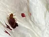 A online community user posted a picture of a bedbug found on the user's trench coat. [SCREEN CAPTURE]