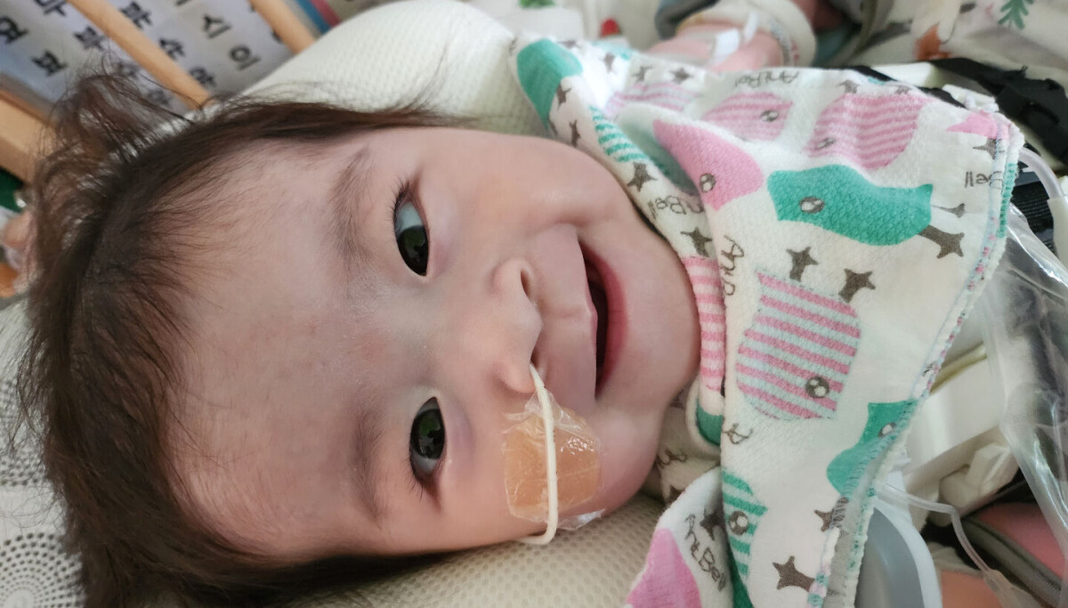 Infant Exposure Rome Asan Medical experts achieve miracle with first infant exposed heart ...