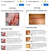 Gold Medalist confirmed with screenshots that the evidence photographs revealed by Hoverlab of the informant’s scars from being physically attacked at the request of Gold Medalist were fake and that they were downloaded from Google. [GOLD MEDALIST]