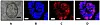A precancerous head and neck organoid model developed by the research team of Yonsei University’s Gangnam Severance Hospital and the University of Southern California [JOONGANG ILBO]