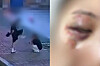 A screen capture of surveillance camera footage where a taekwondo instructor in his 30s assaulted his girlfriend in Goyang, Gyeonggi, on Aug. 2, left, and the injuries suffered by the victim [SCREEN CAPTURE]