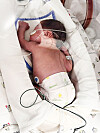 Si-hyeon, a premature newborn born to Shin Min-jeong, 34, in a neonatal intensive care unit [SHIN MIN-JEONG]