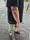 Park, 46, sustained injuries in a sinkhole accident in Namwon on June 21. [PARK]