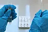 A health official conducts a drug test at a facility in Daegu on Feb. 24. [NEWS1]