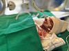 Ye-rang was born prematurely at just 260 grams on April 22 at 25 weeks and five days of gestation. [SAMSUNG HOSPITAL]