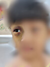 A picture of a 7-year-old child with autism who was allegedly beaten by the child's mother's boyfriend [JOONGANG ILBO]